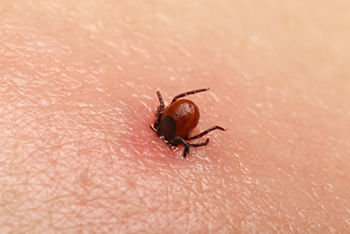 tick in skin in Kansas by American Pest Management