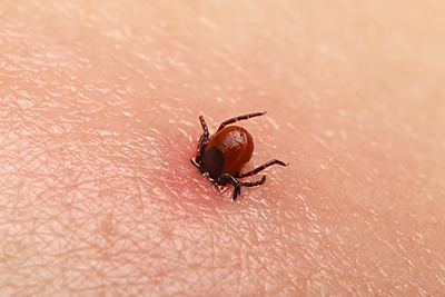 Tick-Borne Diseases in the State of Kansas in your area